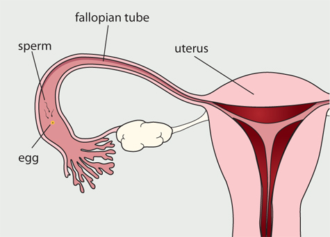 Diagram of the female reproductive system. The egg travels down the fallopian tube. Sperm have entered the fallopian tube and are approaching the egg.